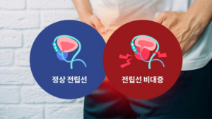 타다라필